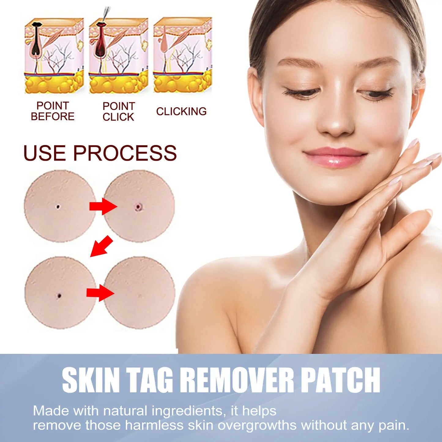 Invisible Blemish & Spot Cover Patch – Skin Sticker 144 pcs