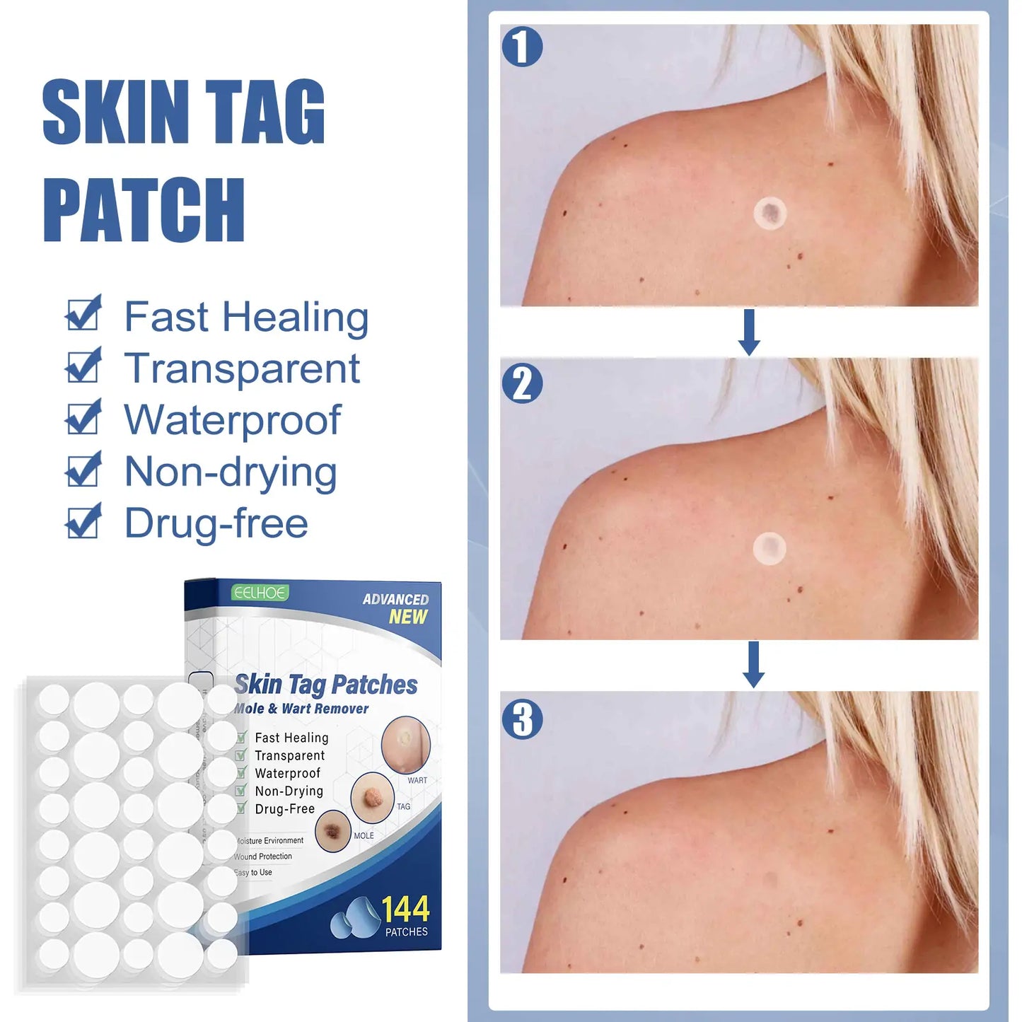 Invisible Blemish & Spot Cover Patch – Skin Sticker 144 pcs