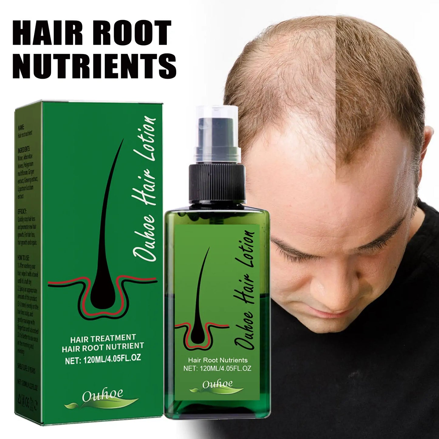 OUHOE Hair Growth Nourishing Spray – Scalp Care & Anti-Hair Loss Treatment