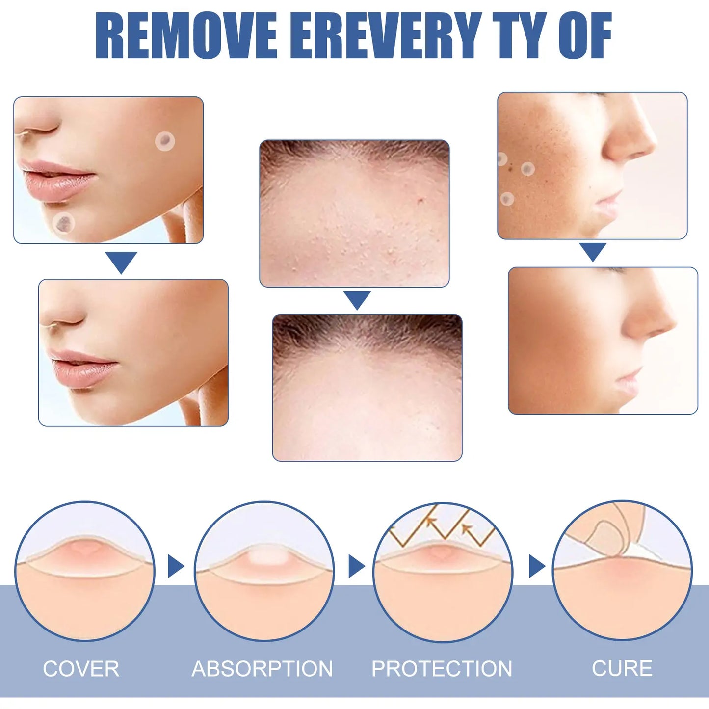 Invisible Blemish & Spot Cover Patch – Skin Sticker 144 pcs