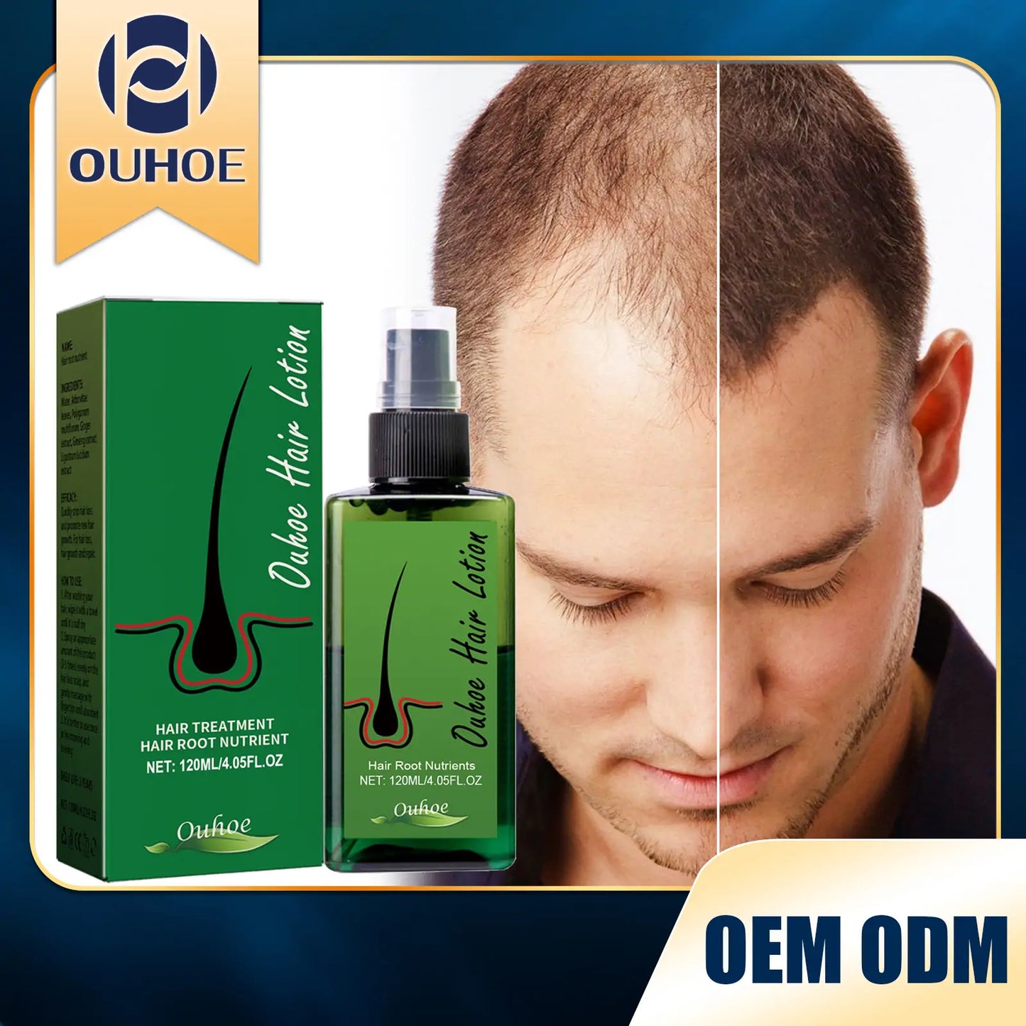 OUHOE Hair Growth Nourishing Spray – Scalp Care & Anti-Hair Loss Treatment