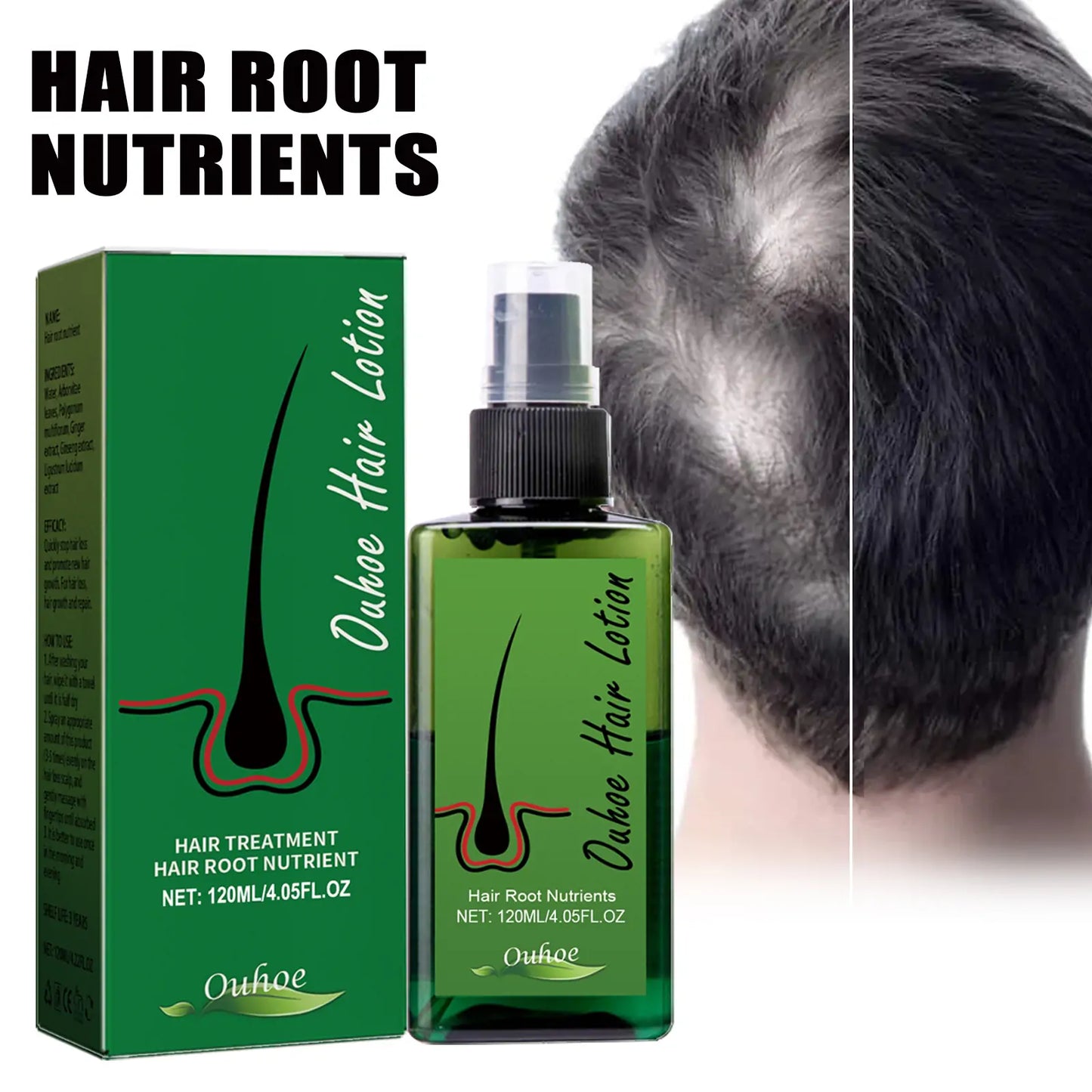 OUHOE Hair Growth Nourishing Spray – Scalp Care & Anti-Hair Loss Treatment