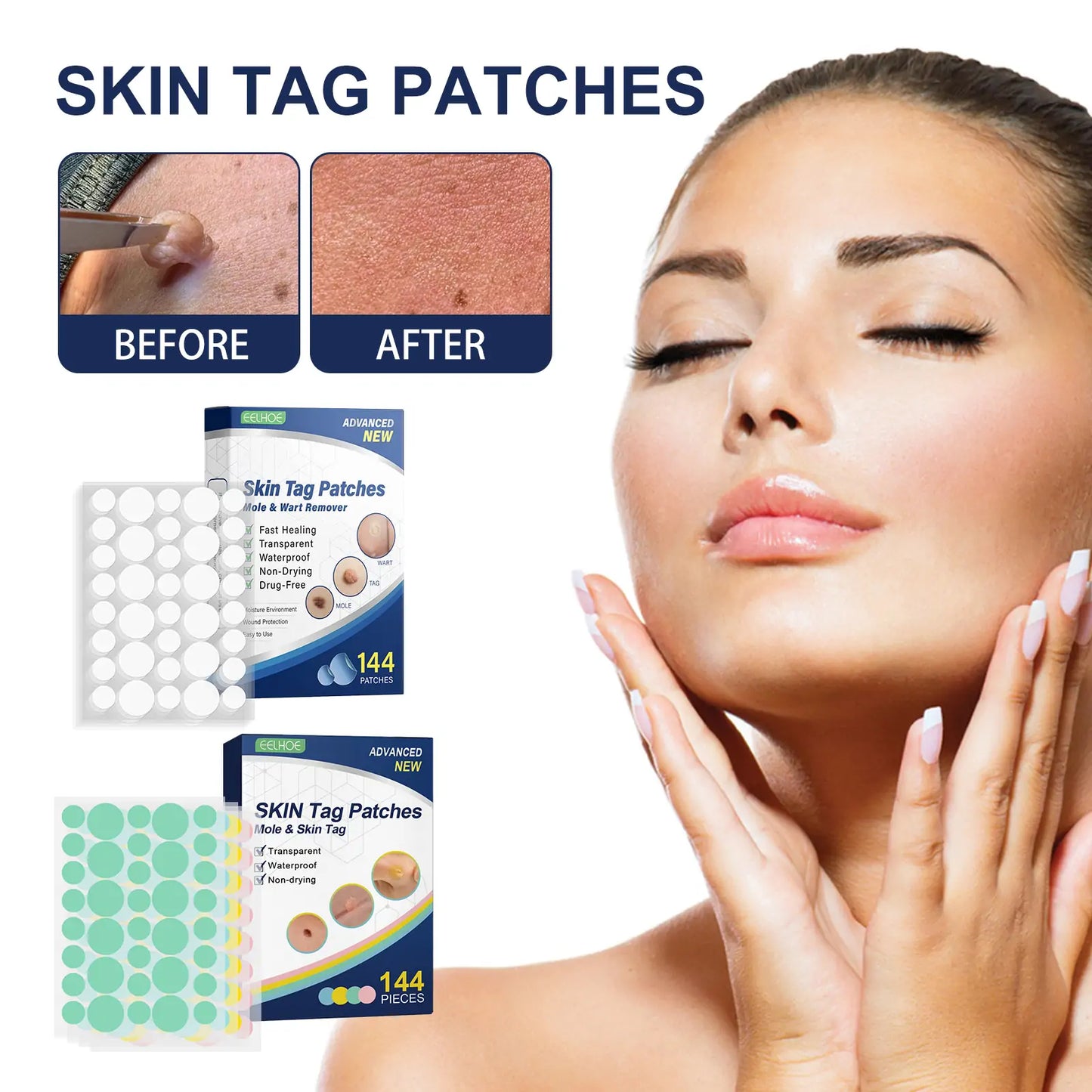Invisible Blemish & Spot Cover Patch – Skin Sticker 144 pcs