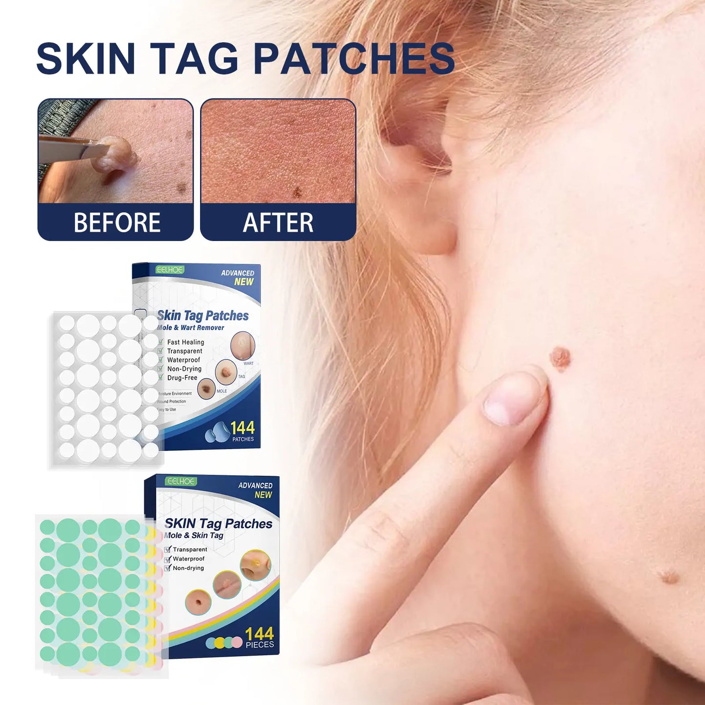 Invisible Blemish & Spot Cover Patch – Skin Sticker 144 pcs