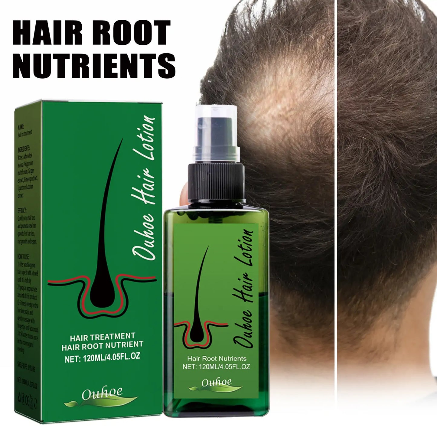 OUHOE Hair Growth Nourishing Spray – Scalp Care & Anti-Hair Loss Treatment