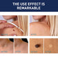 Invisible Blemish & Spot Cover Patch – Skin Sticker 144 pcs