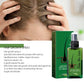 OUHOE Hair Growth Nourishing Spray – Scalp Care & Anti-Hair Loss Treatment