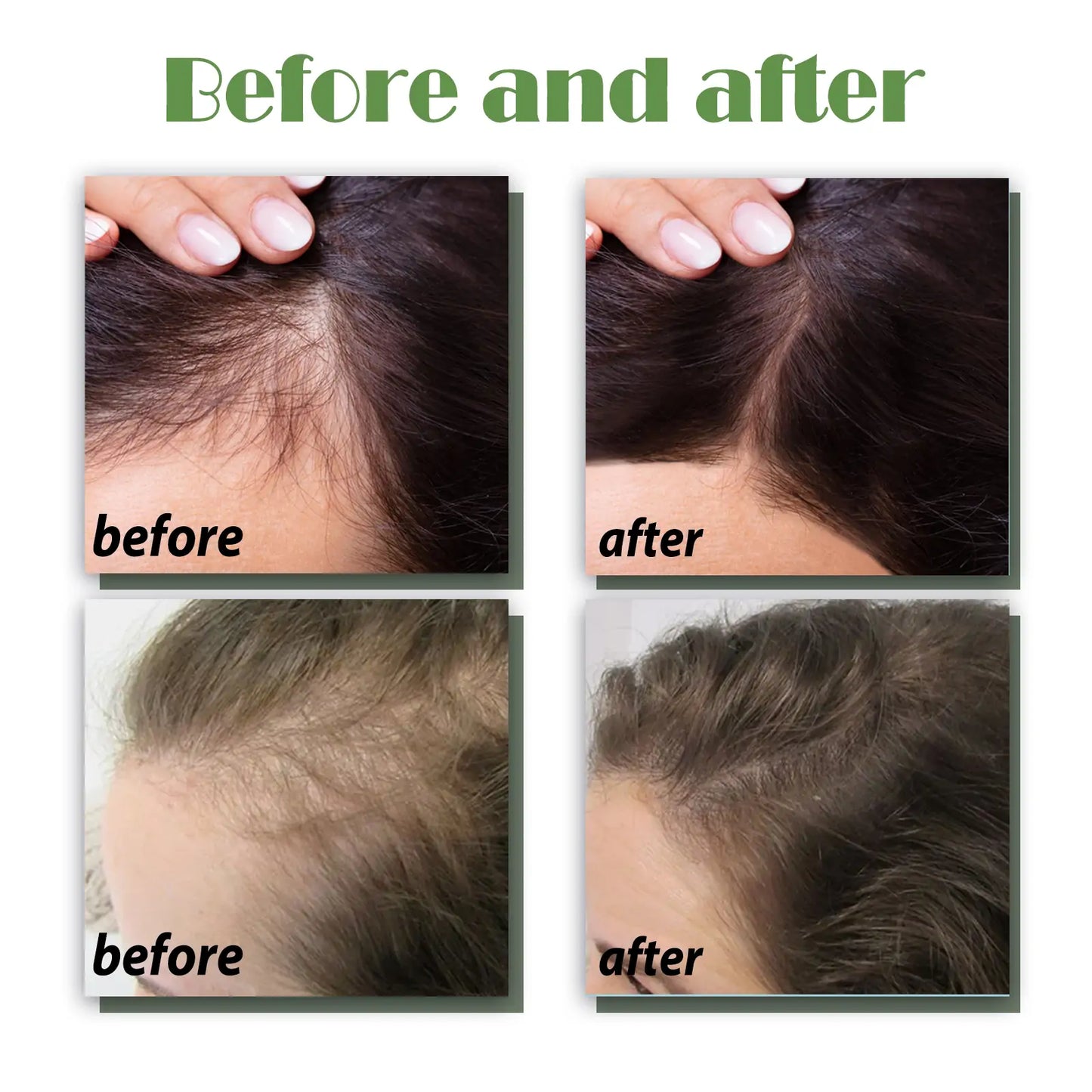 OUHOE Hair Growth Nourishing Spray – Scalp Care & Anti-Hair Loss Treatment