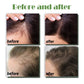 OUHOE Hair Growth Nourishing Spray – Scalp Care & Anti-Hair Loss Treatment