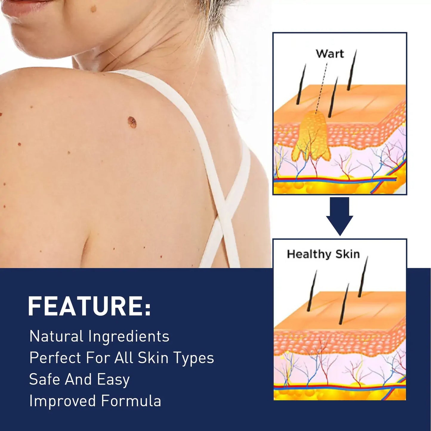 Invisible Blemish & Spot Cover Patch – Skin Sticker 144 pcs