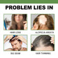 OUHOE Hair Growth Nourishing Spray – Scalp Care & Anti-Hair Loss Treatment